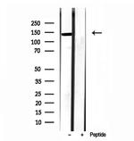 TET2 Antibody in Western Blot (WB)