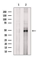 AP2 gamma Polyclonal Antibody