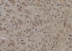 AP2 gamma Polyclonal Antibody