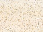 TFAP4 Antibody in Immunohistochemistry (Paraffin) (IHC (P))