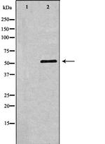 TFEB Polyclonal Antibody
