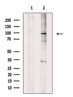 TGFBR3 Polyclonal Antibody