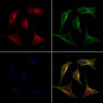 TGFBI Polyclonal Antibody