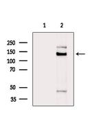TIMELESS Polyclonal Antibody