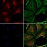 TIMM50 Polyclonal Antibody