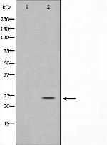 TIMP3 Polyclonal Antibody