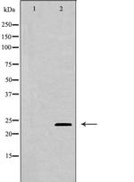 TIMP3 Antibody in Western Blot (WB)