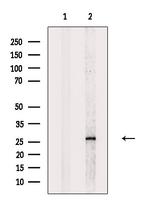 TMEM109 Antibody in Western Blot (WB)