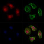 TMEM37 Polyclonal Antibody