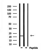 TMEM37 Antibody in Western Blot (WB)