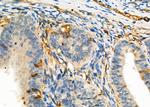 TMPRSS2 Polyclonal Antibody