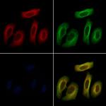 TNF beta Polyclonal Antibody