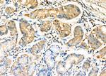 TNFRSF14 Polyclonal Antibody