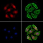 Torc2 Antibody in Immunocytochemistry (ICC/IF)