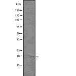 TP53I11 Antibody in Western Blot (WB)
