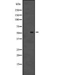 TRIM38 Polyclonal Antibody