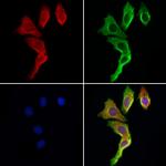 TRIM44 Polyclonal Antibody