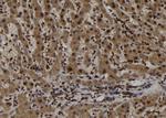 TRIM44 Antibody in Immunohistochemistry (Paraffin) (IHC (P))