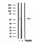 TRIM44 Antibody in Western Blot (WB)