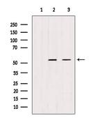 TRIM44 Antibody in Western Blot (WB)