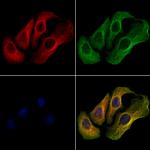 TRPC3 Polyclonal Antibody