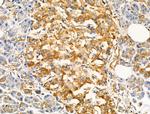 TRPC3 Antibody in Immunohistochemistry (Paraffin) (IHC (P))