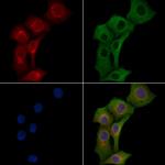 TRPC4 Polyclonal Antibody