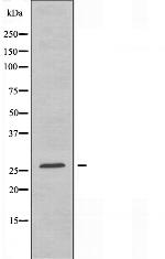 TSPAN8 Polyclonal Antibody