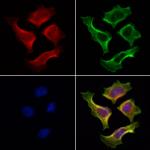 TTC7A Polyclonal Antibody