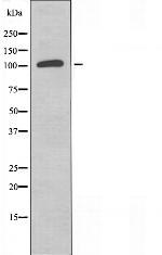 GCP5 Polyclonal Antibody