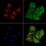 TUT1 Polyclonal Antibody