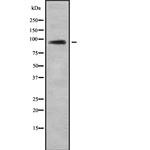 TUT1 Antibody in Western Blot (WB)