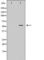 TrxR2 Polyclonal Antibody