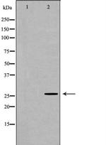 Ubiquitin Antibody in Western Blot (WB)