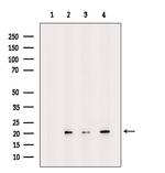UBE2G1 Polyclonal Antibody