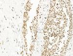 UBR4 Polyclonal Antibody