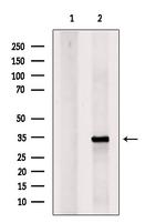 UCP1 Polyclonal Antibody