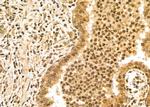 UHRF1 Polyclonal Antibody