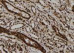 ULK2 Antibody in Immunohistochemistry (Paraffin) (IHC (P))
