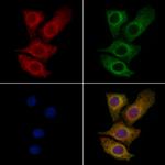 UMPS Polyclonal Antibody