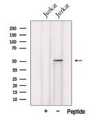UMPS Antibody in Western Blot (WB)