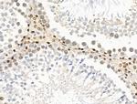 UXT Antibody in Immunohistochemistry (Paraffin) (IHC (P))