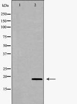 VEGFB Polyclonal Antibody