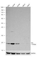 VHL Polyclonal Antibody