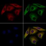 VPS29 Polyclonal Antibody