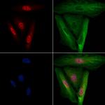 CHX10 Polyclonal Antibody