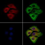 WISP2 Polyclonal Antibody