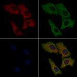 Wnt10B Polyclonal Antibody