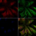 WNT5B Polyclonal Antibody