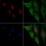 WT1 Polyclonal Antibody